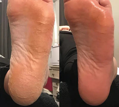 Resultado antes y después