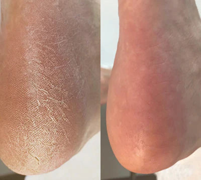Resultado antes y después