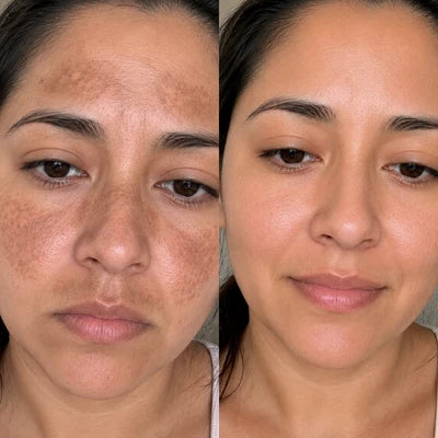 Daniela, 34 años