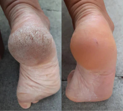 Resultado antes y después