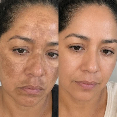 Marisol, 43 años