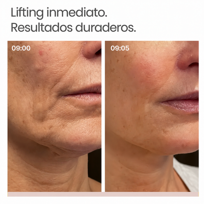 Sérum de efecto lifting inmediato Elovya K-Lift™