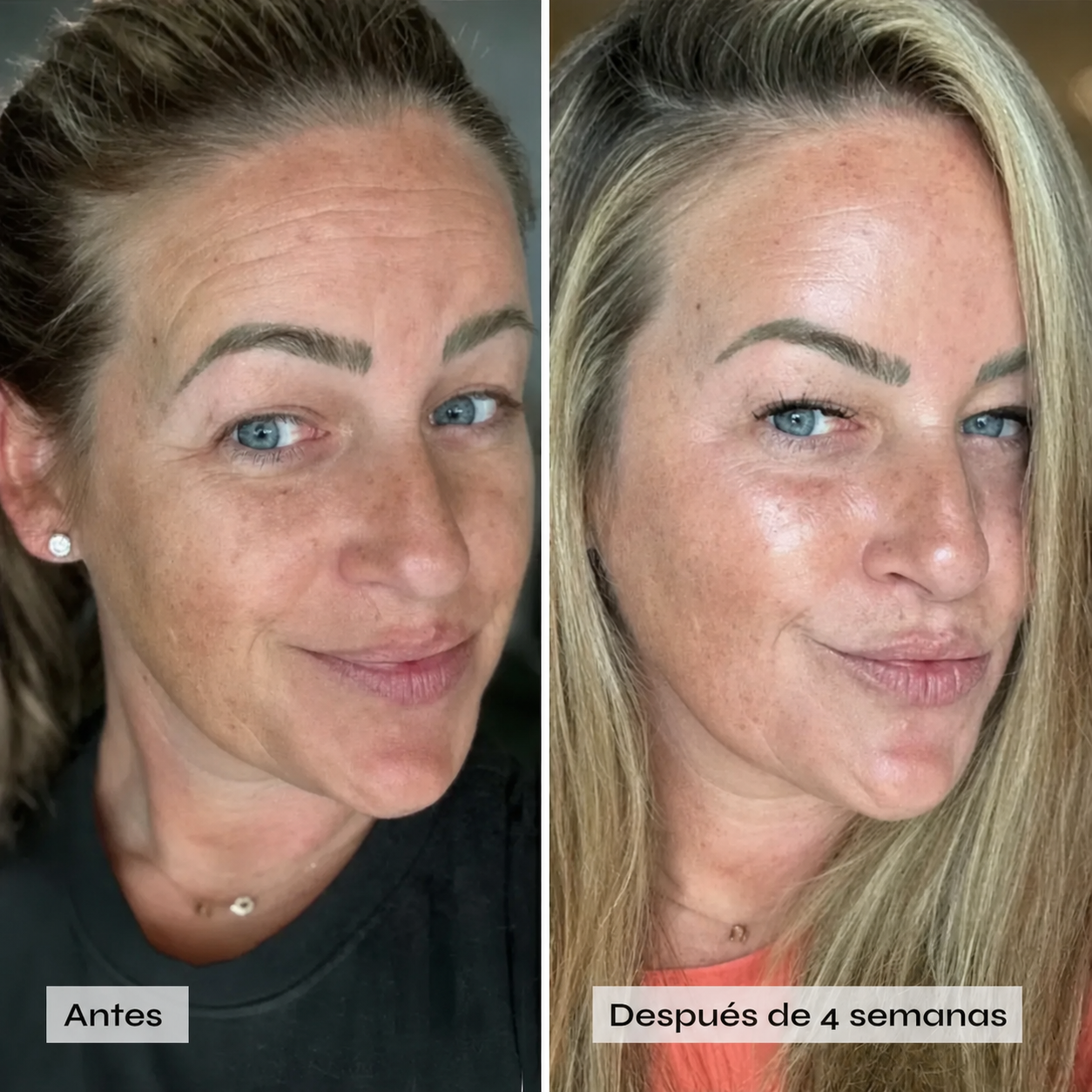 Mascarilla potenciadora de colágeno