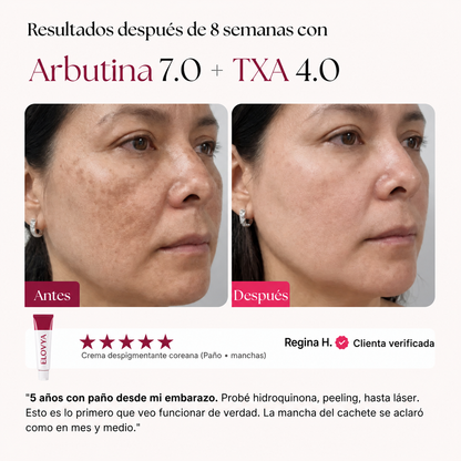 Elovya Antimanchas · Fórmula de acción cuádruple