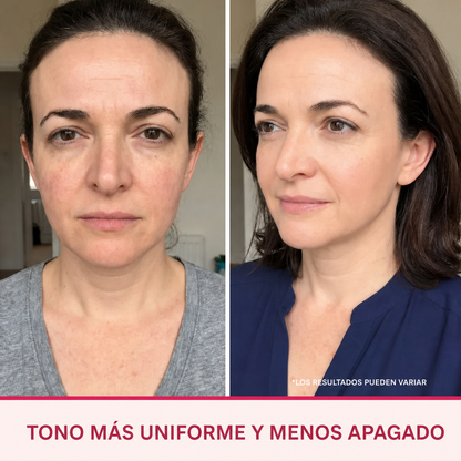 Elovya Cosmetics – Sérum coreano con efecto lifting desde la primera aplicación