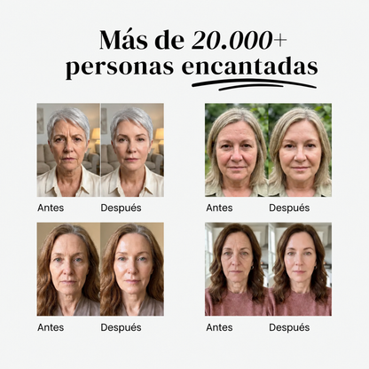 Elovya™ – Alisador de líneas para una piel perfecta en 3 minutos
