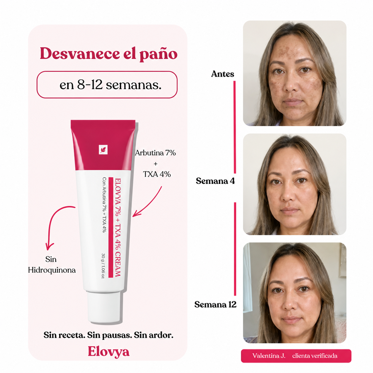 Elovya Antimanchas · Fórmula de acción cuádruple