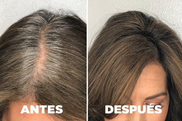 Comparativa antes y después
