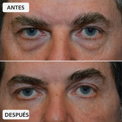 Elovya Crema para bolsas y ojeras