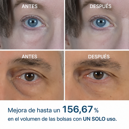 Elovya Crema para bolsas y ojeras