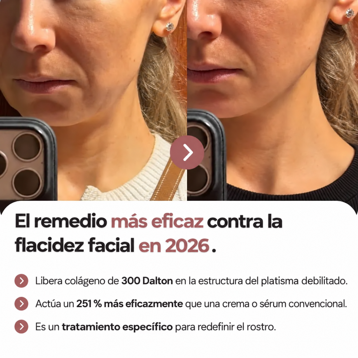 Elovya – Dispositivo de compresión con liberación de colágeno de 300 daltons