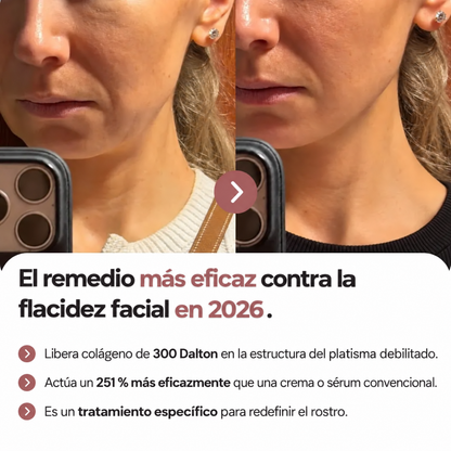 Elovya – Dispositivo de compresión con liberación de colágeno de 300 daltons