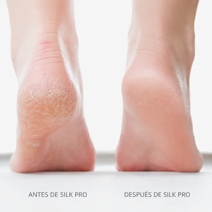 Bliss Silk Pro 2: pies suaves sin gastar en caros tratamientos de pedicura
