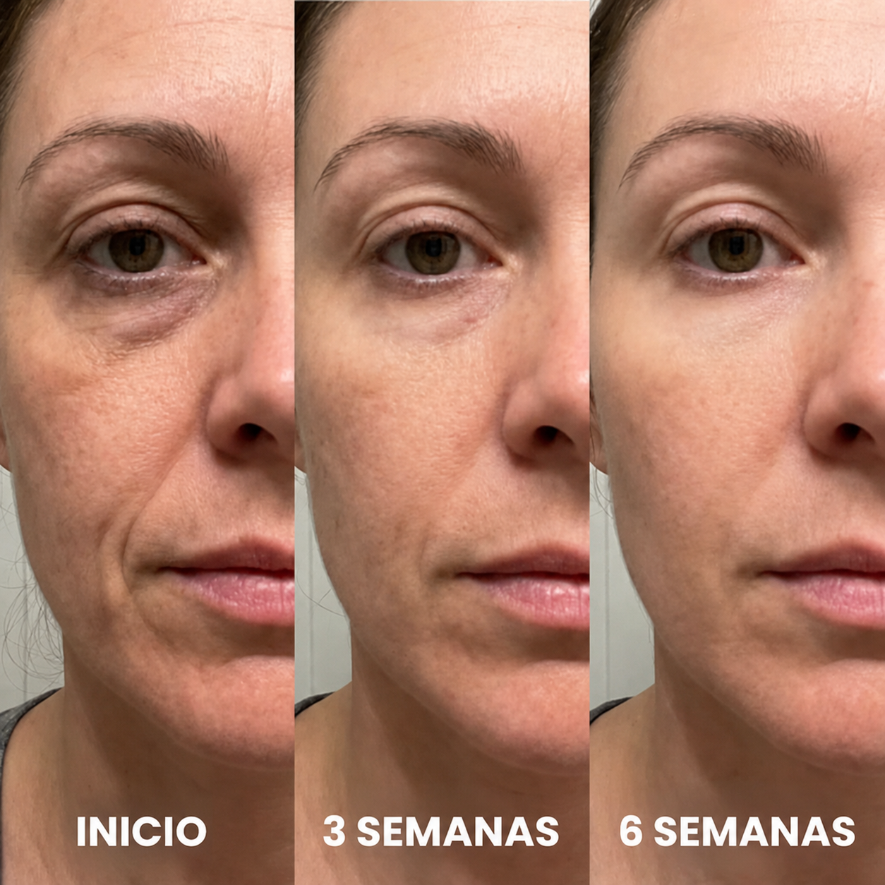 Comparación de resultados del tratamiento