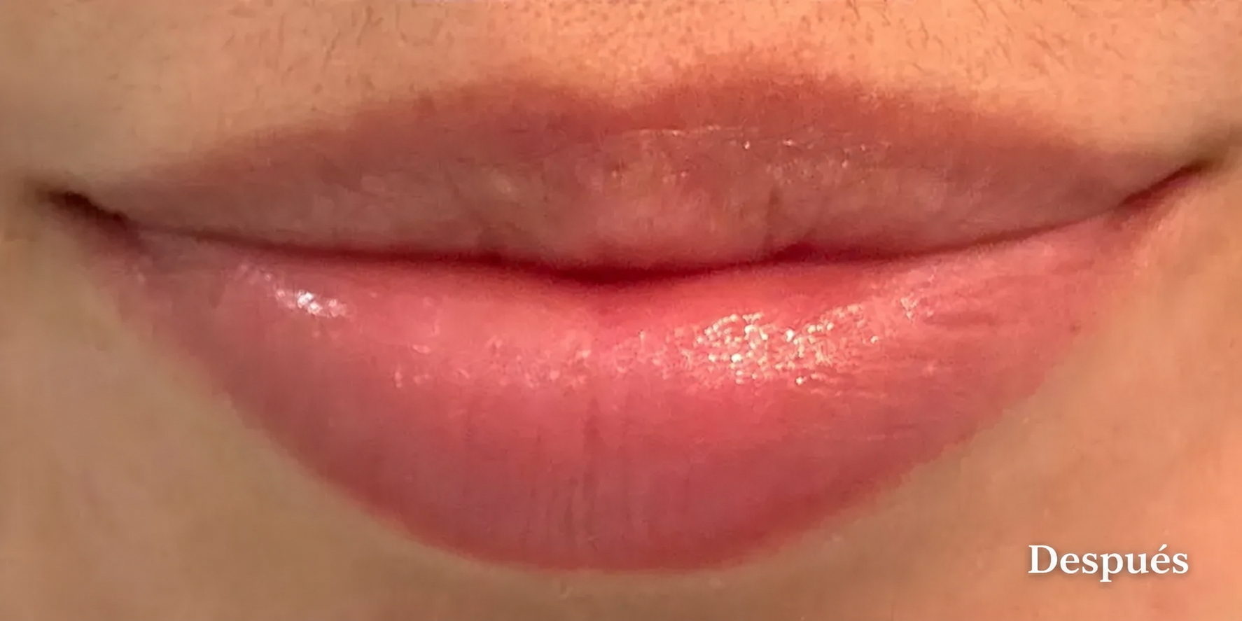 Antes