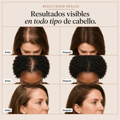 Sérum capilar Elovya