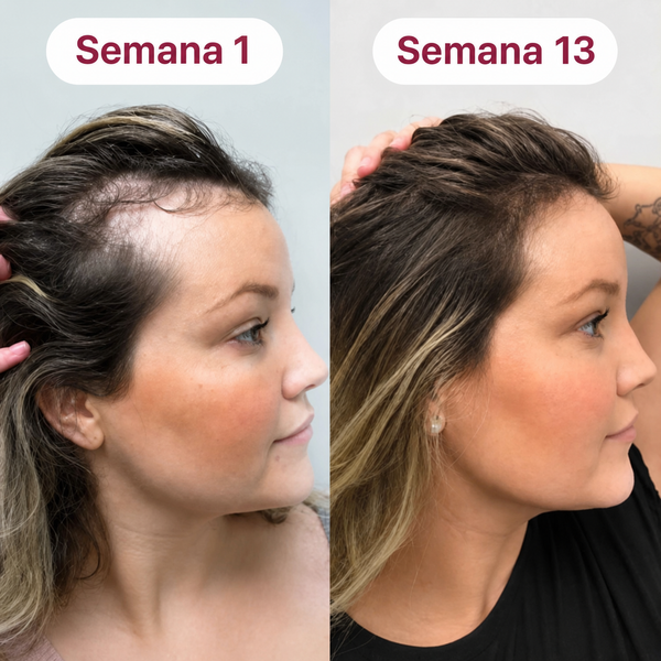 Resultado antes y después 5