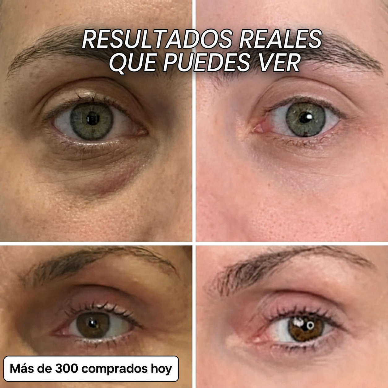 Stick repulpante de biocolágeno con PDRN