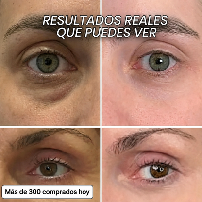 Stick repulpante de biocolágeno con PDRN