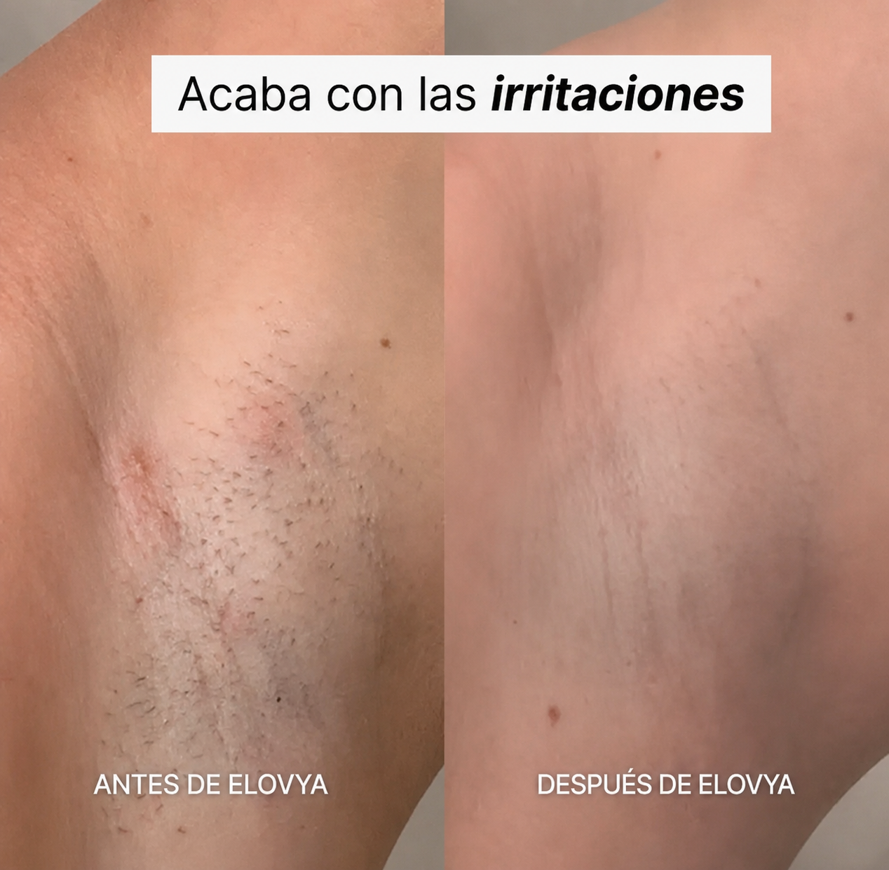 Afeitadora 5 en 1 Elovya®
