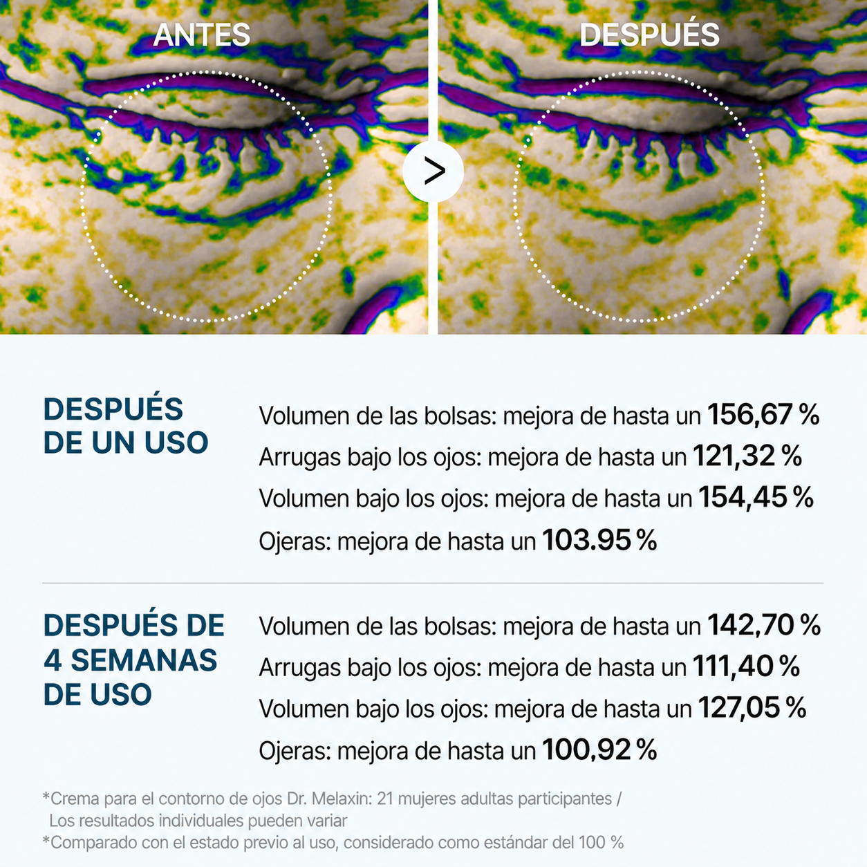Elovya Crema para bolsas y ojeras