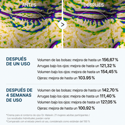 Elovya Crema para bolsas y ojeras