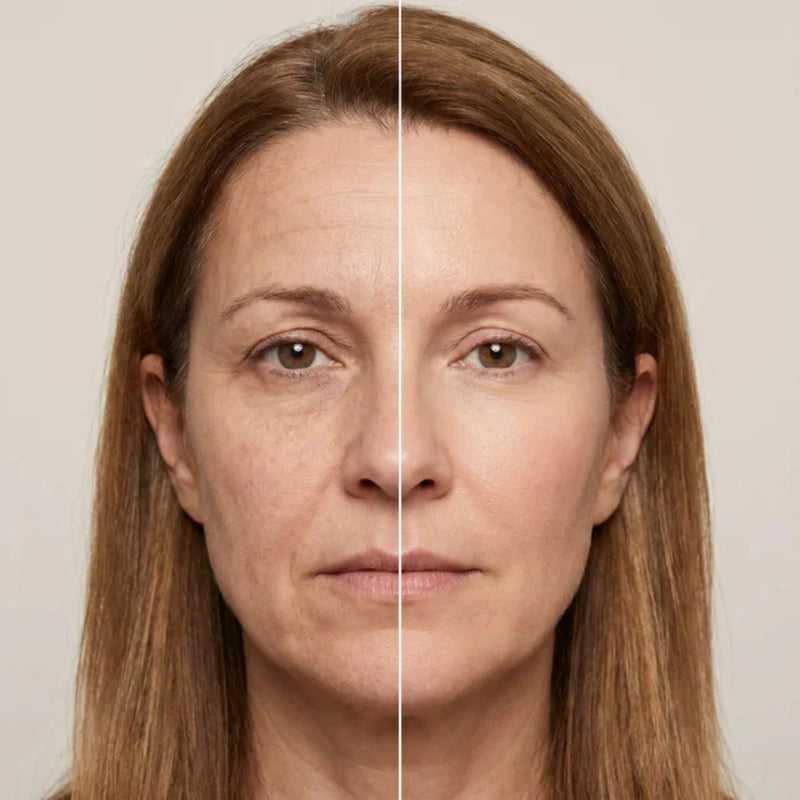 Before and after comparison 1