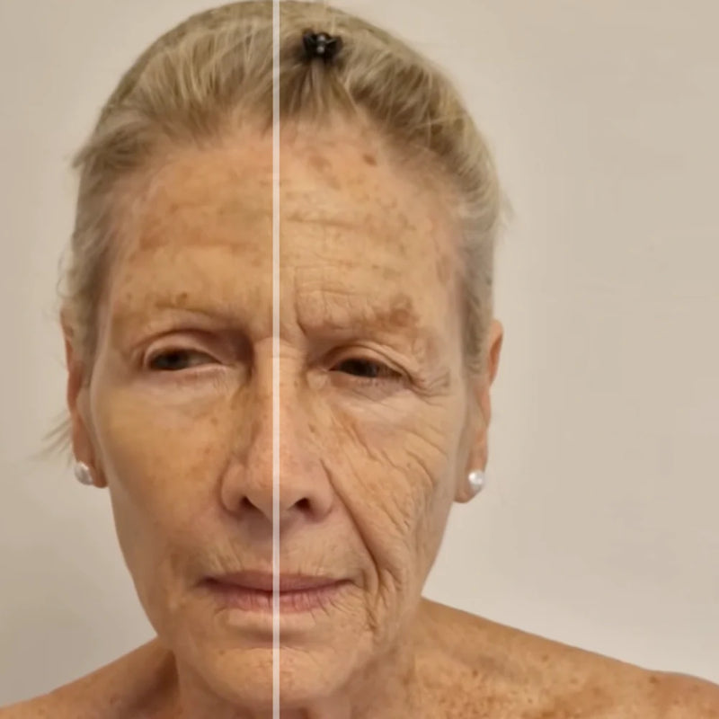 Before and after comparison 2