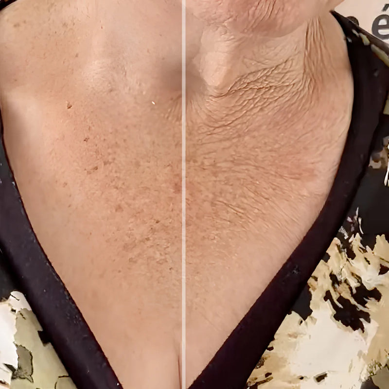 Before and after comparison 5