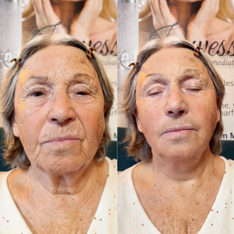 Before and after comparison 6
