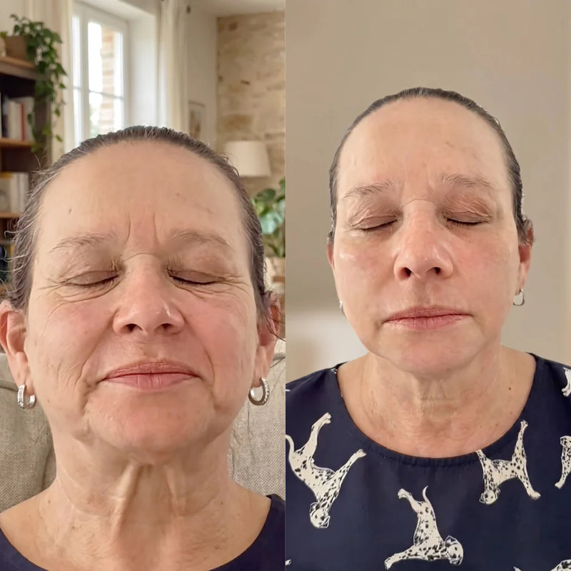 Before and after comparison 7